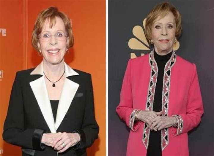 Carol Burnett's Plastic Surgery Journey Revealed
