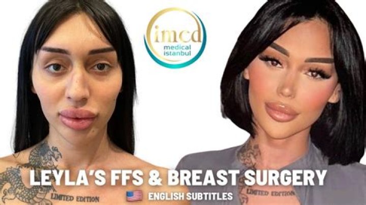 Fans Focus on Alyson Hannigans Plastic Surgery and Breast Implants!Do the rumors about Alyson