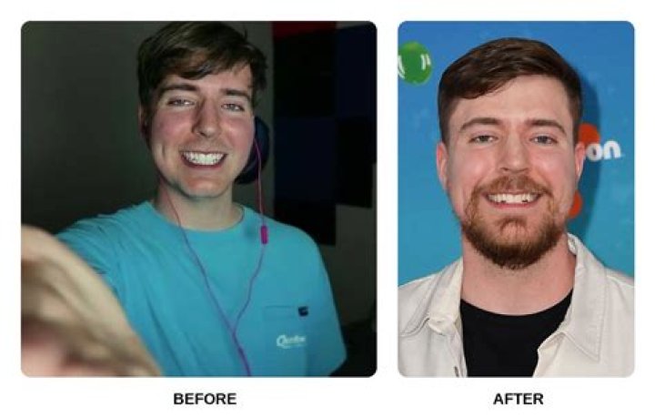 Matt Rife's Teeth Before And After