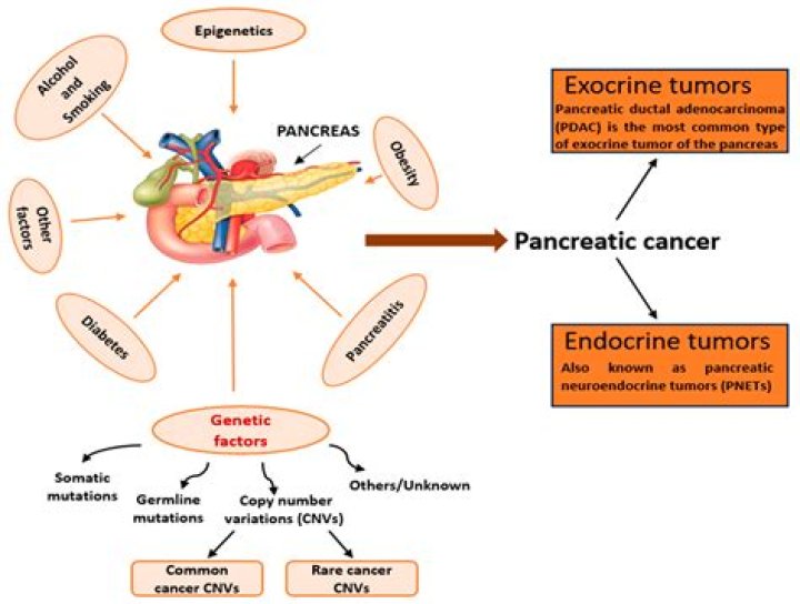 Unlocking Hope And Progress In Pancreatic Cancer