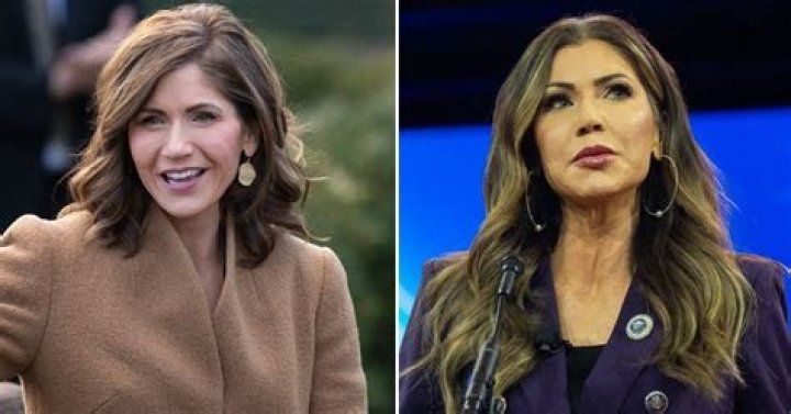 Unveiling Ivana Trump's Plastic Surgery Journey: Discoveries And Insights